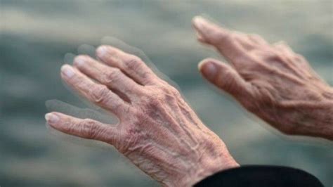 Parkinson La Importancia Del Alerta Temprana Caeme