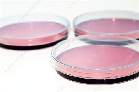 Cell Cultures In Petri Dishes Stock Image C003 7291 Science Photo