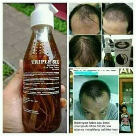 Jual Triple Six Hair Tonic Ginseng Shopee Indonesia