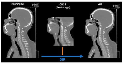 Cone Beam Ct Vs Conventional The Best Picture Of Beam