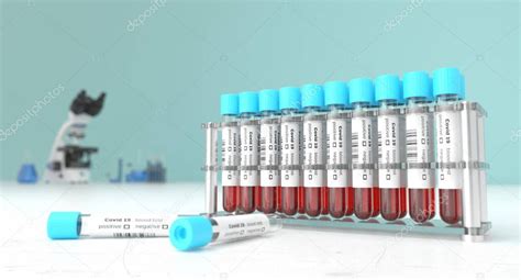 Análisis de sangre del coronavirus en un laboratorio para Covid-19 ...