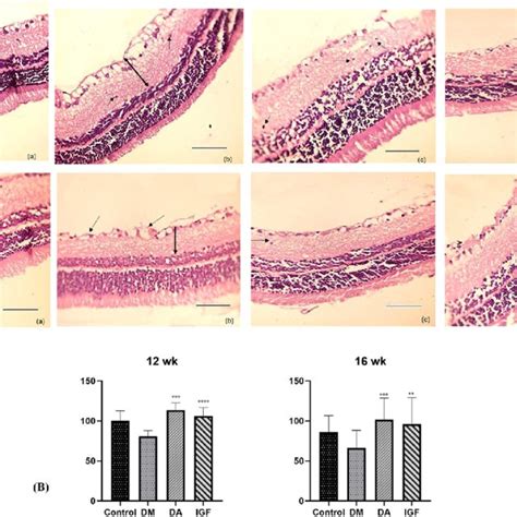 Representative Photomicrographs Of Ultrastructure Of Retinal Capillary