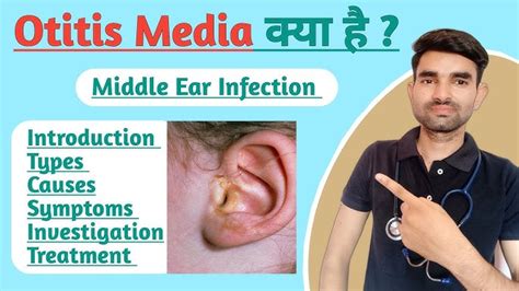 Ruptured Eardrum' Is A Small Hole In The Eardrum And Can Be, 60% OFF