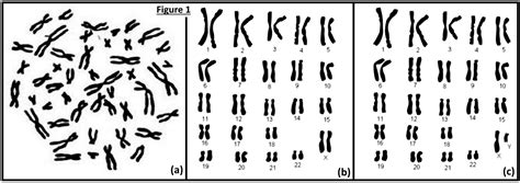 Chapitre Les R Les De La M Iose Et De La F Condation Dans La