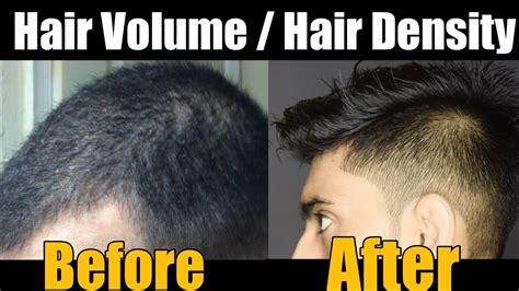 How To Increase Hair Volume Hair Density Naturally Fill Hair Gap