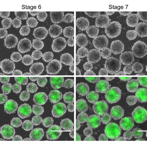 Directed Differentiation Of Hpscs Into Pancreatic Progenitor Cells