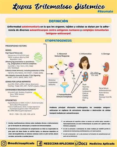 Lupus Eritematoso Sistemico Udocz