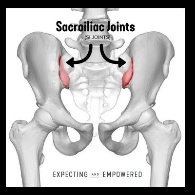 How To Fix Si Joint Pain Joseph Mi Chiropractor Shows How To Fix