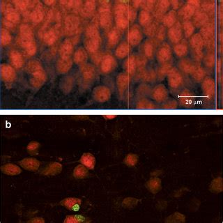 Representative Photomicrographs Of Brdu Labeled Cells In The Forebrain