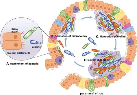 The Mechanisms Of Biofilm Antibiotic Resistance In Chronic R Medicine