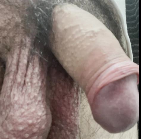 My Uncut Foreskin Play Gay Uncut American Porn Xhamster Xhamster
