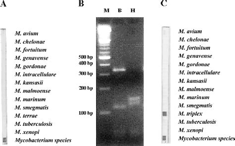 Figure 1 From Disseminated Mycobacteriosis Caused By Drug Resistant