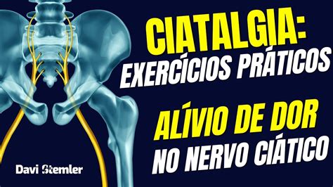 Ciatalgia Alongamentos e Exercícios PRÁTICOS e SIMPLES para Alivio da