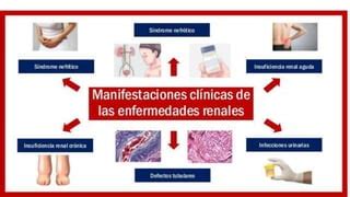 Enfermedades del riñon PPT