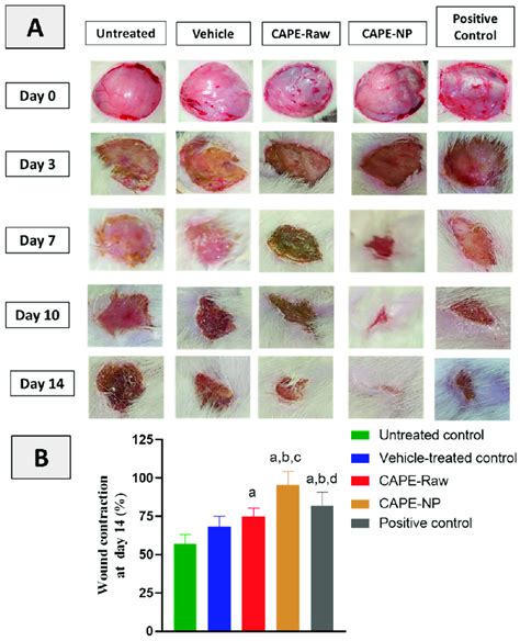 (A) Effects of CAPE-NPs on wound healing and % wound contraction on ...