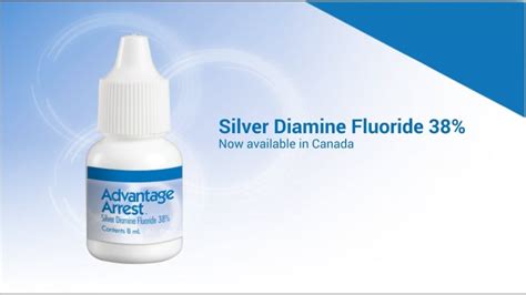 Silver Diamine Fluoride (SDF) is a non-invasive treatment option for ...