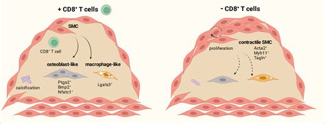 Cd T Cells Drive Plaque Smooth Muscle Cell Dedifferentiation In