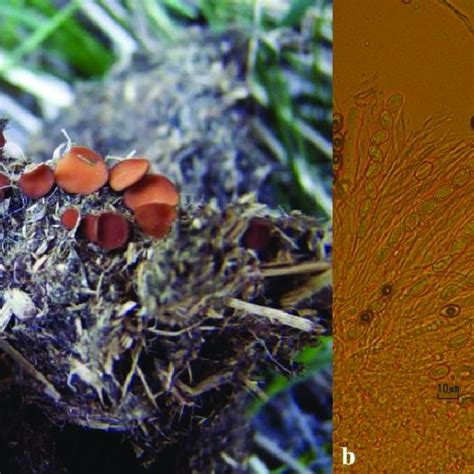 Pseudombrophila Merdaria A Ascocarps B Asci And Paraphyses