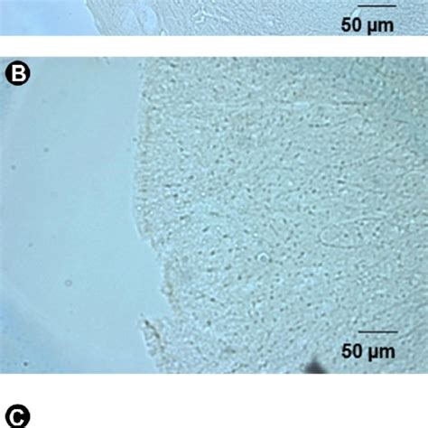 Photomicrographs Showing The Expression Of C Fos Protein In The Spinal