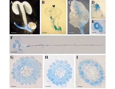 Histochemical Analysis Of Arabidopsis Pcgmt Glucuronidase Gus