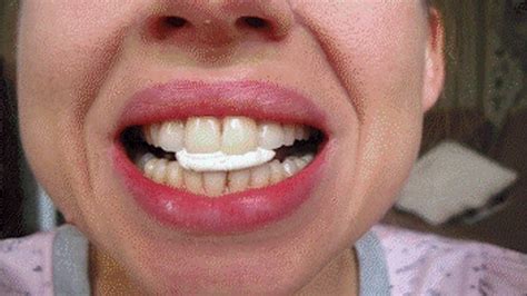 Most Large Teeth In The World Mouth Fet Fantasies Of Beautiful Blonde Clips Sale