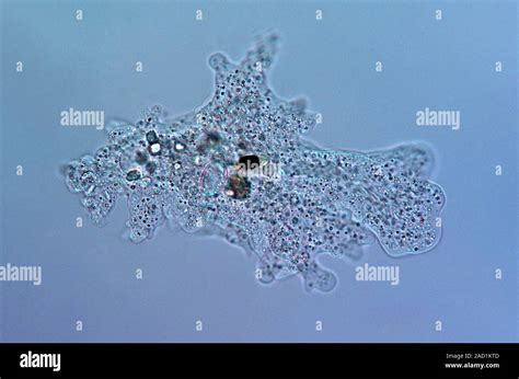 Amoeba Protozoa Polarised Light Micrograph Of An Amoeba Sp Protozoa