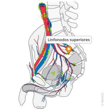 Linfonodos Nível 2 E 3 - Linfonodos superiores - e-Anatomy - IMAIOS