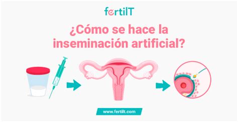 Cómo se hace la inseminación artificial