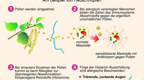 Immunsystem Falsch Gesteuert Bedeutet Allergie Gesundheit