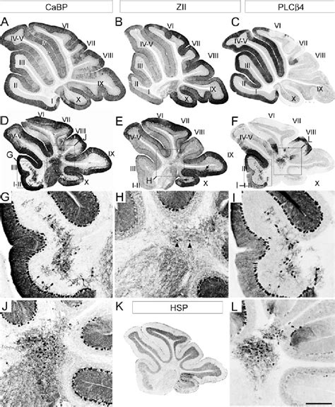 Figure 2 From The Reelin Receptors Apoer2 And Vldlr Coordinate The