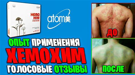 ОТЗЫВЫ ЛЮДЕЙ ХЕМОХИМ | ЧЕСТНО про HemoHim #атоми #хемохим #atomy # ...