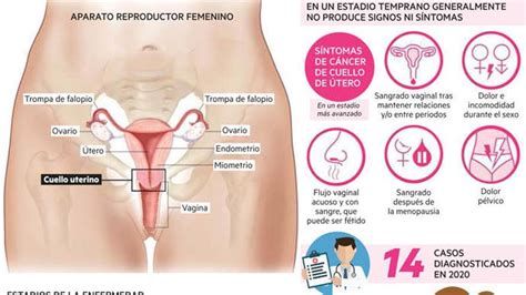 El Cáncer De Cérvix En Navarra En Datos Y Gráficos