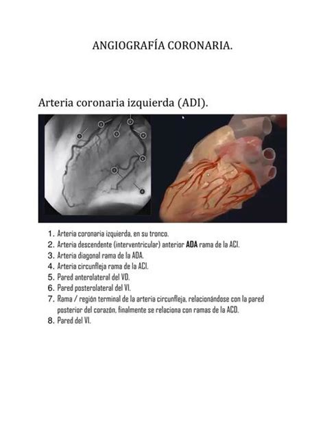 ANGIOGRAFiA CORONARIA Manuela Herrera M UDocz