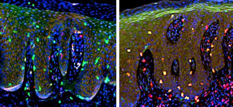 Figure From Pathophysiology Of Skin Resident Memory T Cells