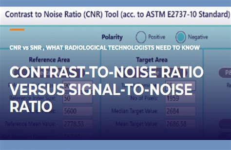 CNR VS SNR , WHAT RADIOLOGICAL TECHNOLOGISTS NEED TO KNOW