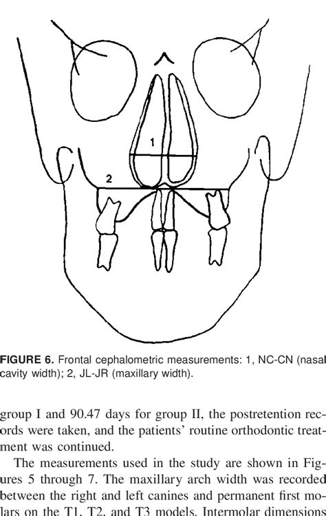 Lateral Cephalometric Measurements 1 Sna 2 Snb 3 Anb 4 Sn Mp Download Scientific