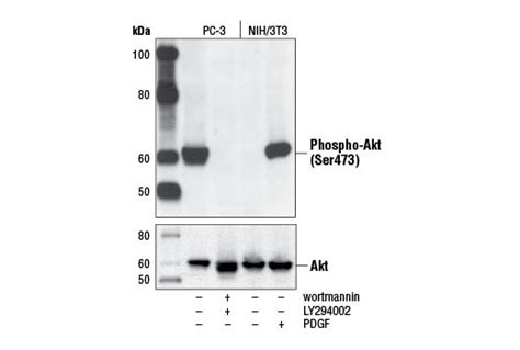 Phospho Akt Ser473 D9e Xp® Rabbit Mab Cell Signaling Technology