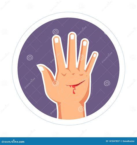 Injury Cut on Hand Bleeding Scratch Skin Damage Stock Vector ...