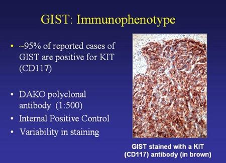 Diagnosis Pathology Results Gist Support International