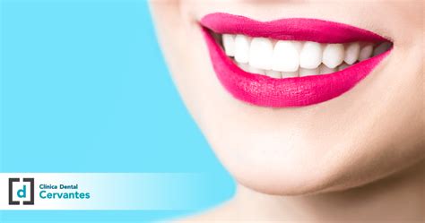 Preguntas Frecuentes Sobre El Blanqueamiento Dental Cl Nica Dental