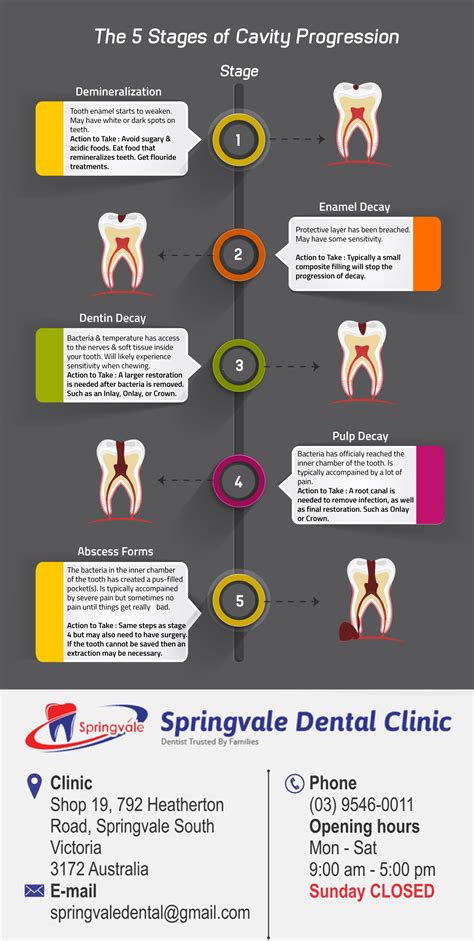 Stages Of Cavity Progression | Symptops, Causes, Treatment