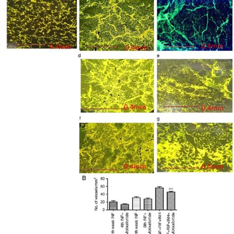 A Immunofluorescence Stained Slides Showing The Expression Of Vegfa