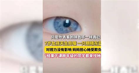 7歲女孩「天生異瞳」一眼黑一眼灰藍 醫生揭原因：1情況快就醫 兩岸大陸 三立新聞網 Setncom