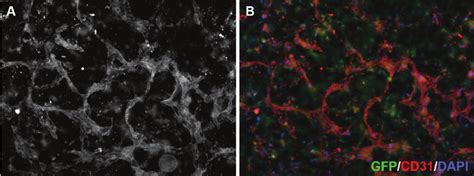 3d Neoangiogenesis Model Human Microvascular Endothelial Cells Grown Download Scientific