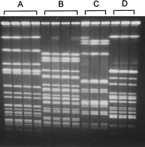 Pulsed Field Gel Electrophoresis Of Escherichia Coli Isolated From Male