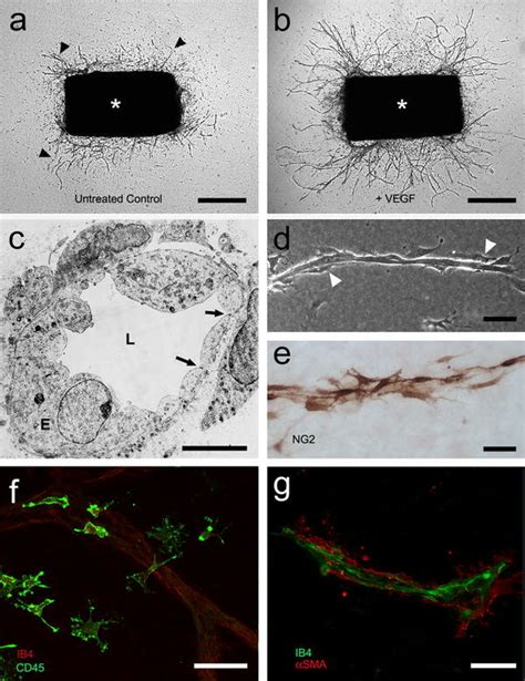 Aortic Ring Assay Of Angiogenesis A Serum Free Collagen Gel Culture Of