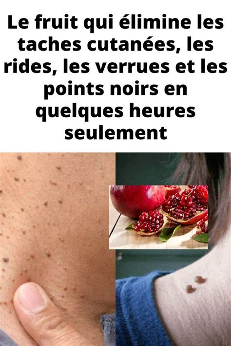 Le fruit qui élimine les taches cutanées les rides les verrues et les