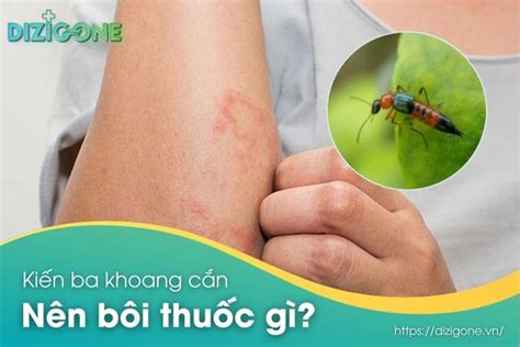 Bội của một số là gì Tìm hiểu chi tiết cách tính và ứng dụng thực tiễn