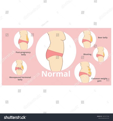 Menopause Tummy Tuck at Terry Knapp blog
