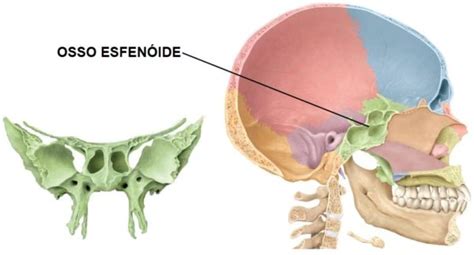 Osso Esfenoide Anatomia E Fun O Ossos Do Neurocr Nio